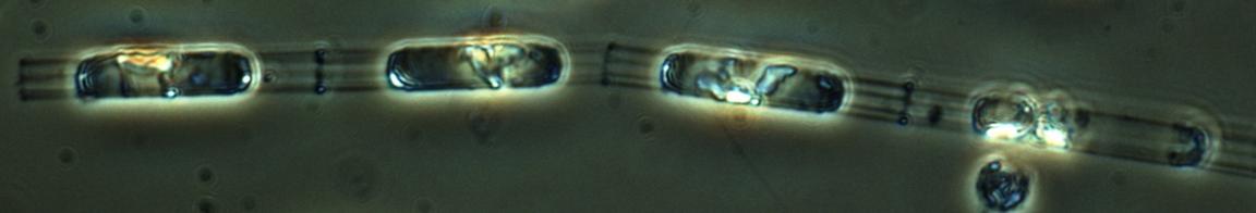  mikroskopbild på växtplankton